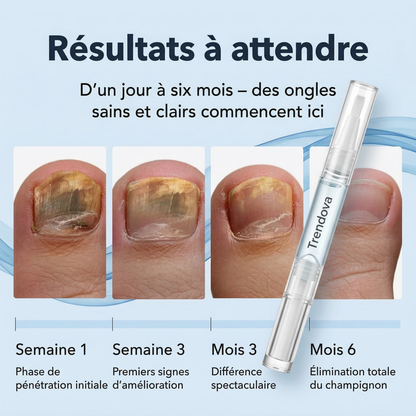 Traitement Antifongique Trendova